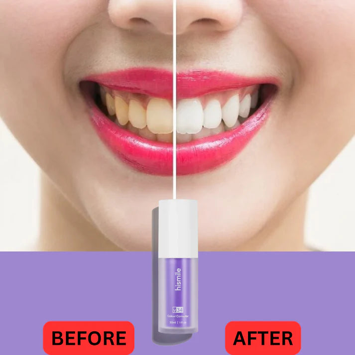 HiSmile V34 Advanced Teeth Whitening Serum